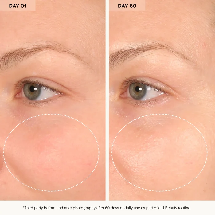 The Barrier Bioactive Treatment