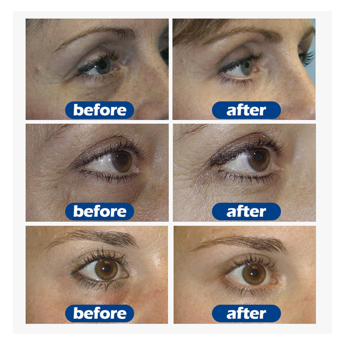 Collagen Dark Circles Eye Cream EELHOE COSMETICS