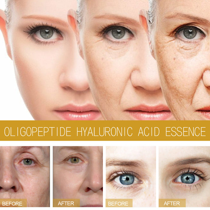 EELHOE Collagen Facial Skin Fading & Rejuvenation Wrinkle Treatment – Restore Youthful Radiance EELHOE COSMETICS
