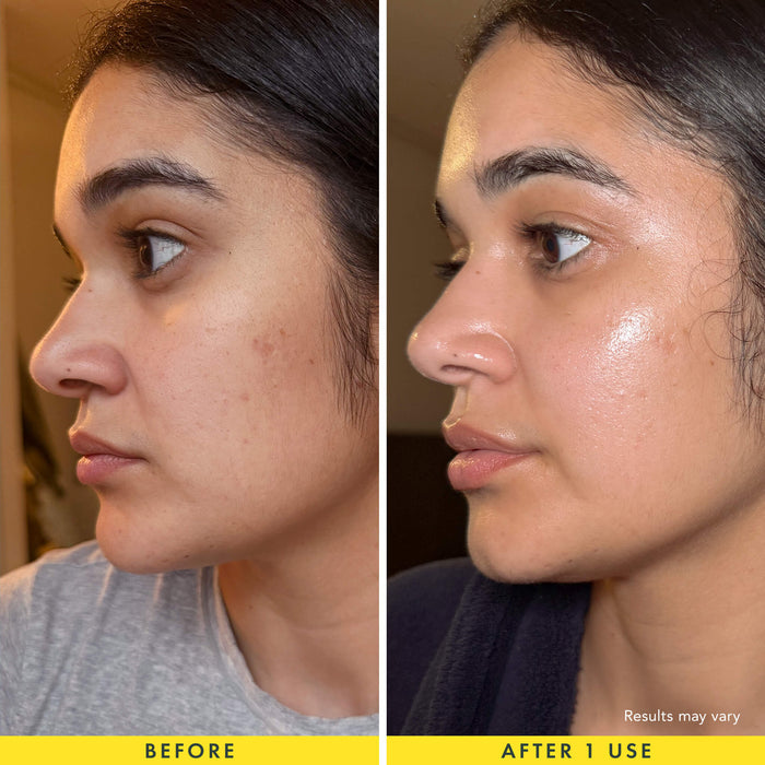 Before-and-after side-by-side comparison of a woman's face, showing skin texture and appearance. The left side is labeled 'BEFORE' and shows dry, less radiant skin, while the right side is labeled 'AFTER 1 USE' and shows a smoother, more hydrated complexion.
