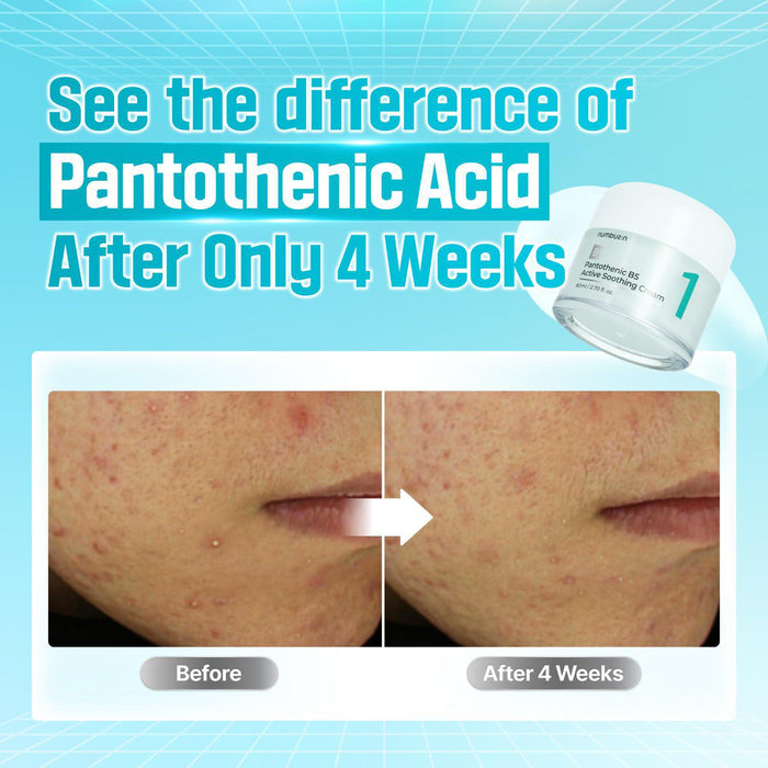 Numbuzin No.1 Pantothenic B5 Active Soothing Cream 80 mL