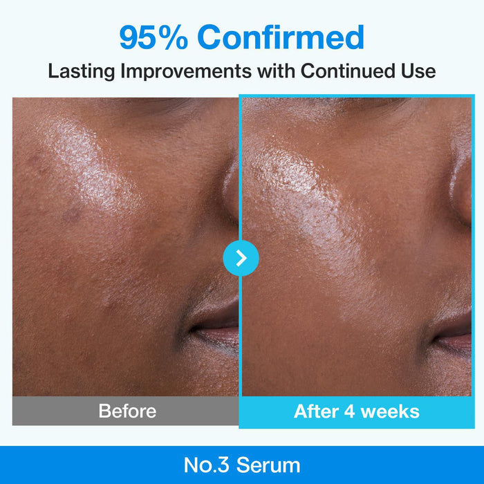 Numbuzin No.3 Blue Bio-Retinol Pore Refining Serum 30 mL